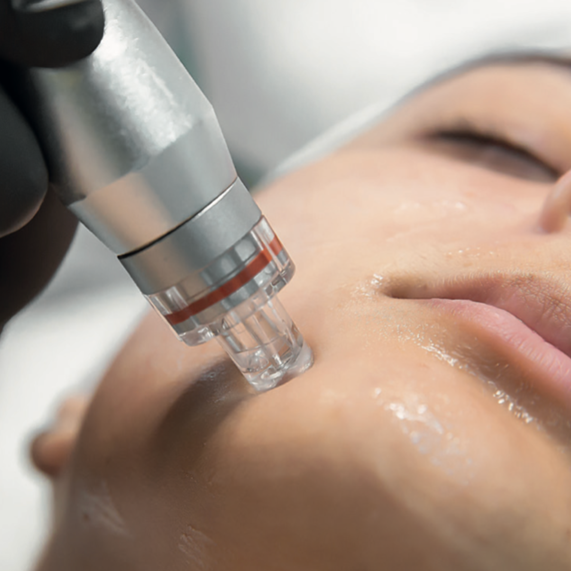 Hydrabrasion Facial Deluxe