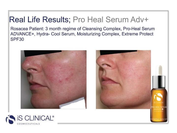 Pro-Heal Serum Advance+